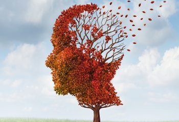 Alzheimerova bolest razvija se postupno