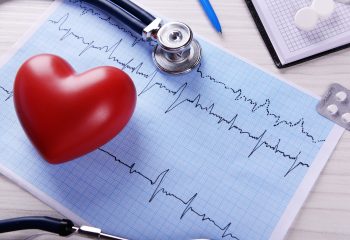 Fibrilacija atrija (AFIB) i visoki tlak su najčešći rizični faktori za bolesti srca i nastanak moždanog udara