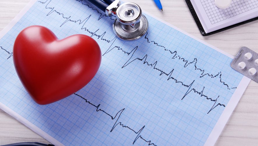 Fibrilacija atrija (AFIB) i visoki tlak su najčešći rizični faktori za bolesti srca i nastanak moždanog udara