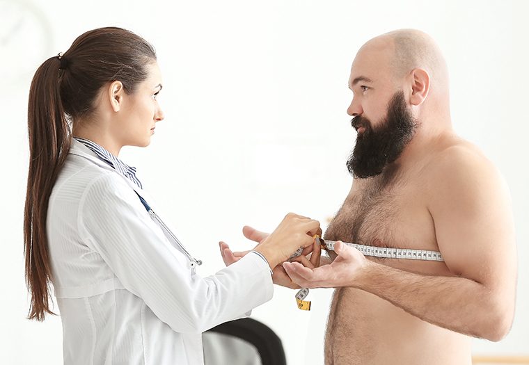 ginekomastija, povećane grudi kod muškaraca