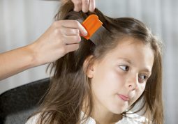 Uši u kosi i kako ih se riješiti