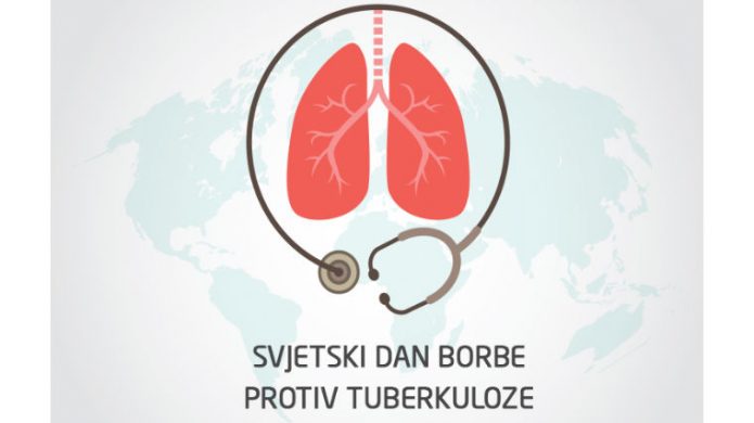 Svjetski dan borbe protiv tuberkuloze: Uzroci, simptomi i liječenje