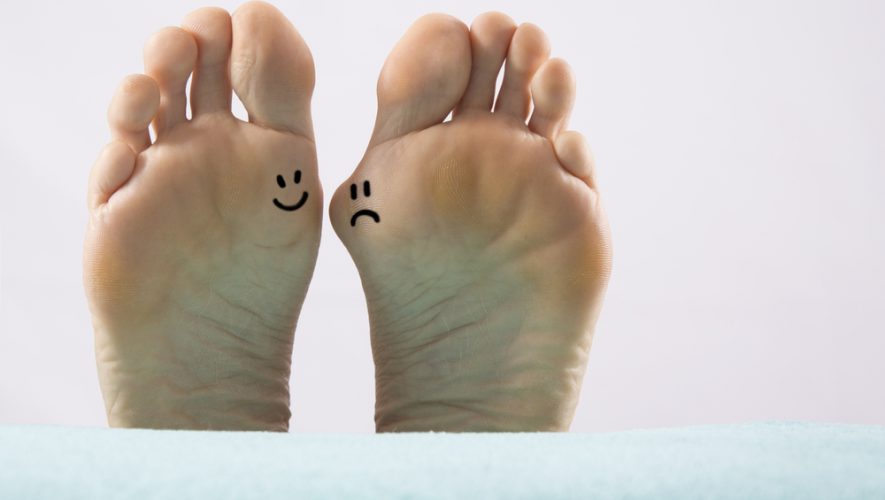 Čukalj, Hallux valgus, deformacija nožnog palca
