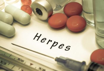 Herpes zoster: Uzroci, simptomi i liječenje virusne infekcije