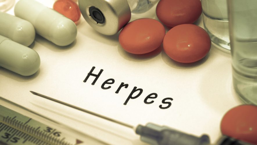 Herpes zoster: Uzroci, simptomi i liječenje virusne infekcije