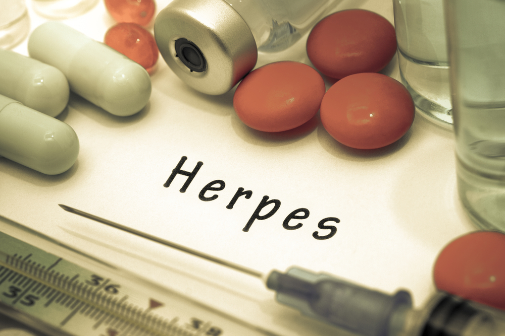 Herpes zoster: Uzroci, simptomi i liječenje virusne infekcije