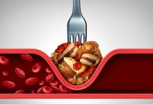 dobar i loš kolesterol - koja je razlika