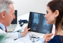 osteoporoza i zdravlje - stavite kosti na prvo mjesto