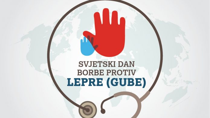 Svjetski dan borbe protiv lepre_Lepra ili guba i dalje je prisutna u svijetu