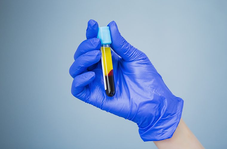 COVID-19- lijecenje-krvnom-plazmom- koronavirus