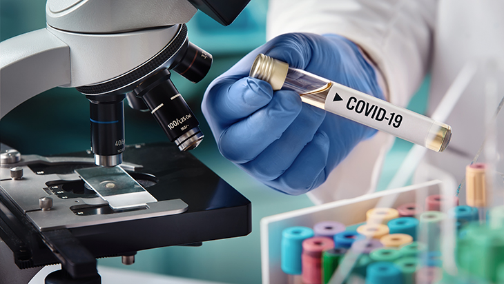 seroloski testovi za koronavirus covid-19 pandemija 2