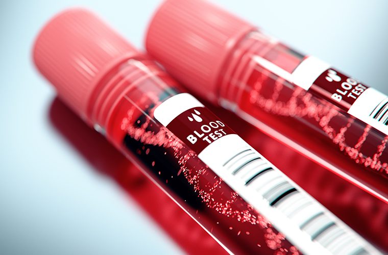 seroloski testovi za koronavirus covid-19 pandemija