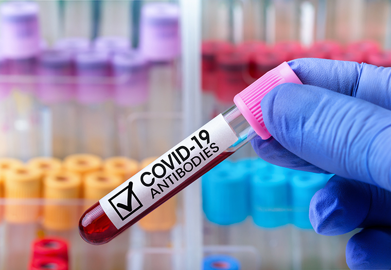 COVID-19 lijecenje krvnom plazmom koronavirus lijecenje oboljelih