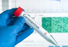 koronavirus COVID-19 drugi val Epidemioloske mjere Bernard Kaic socijalno distanciranje cjepivo zastitne maske imunitet krda seroloski testovi