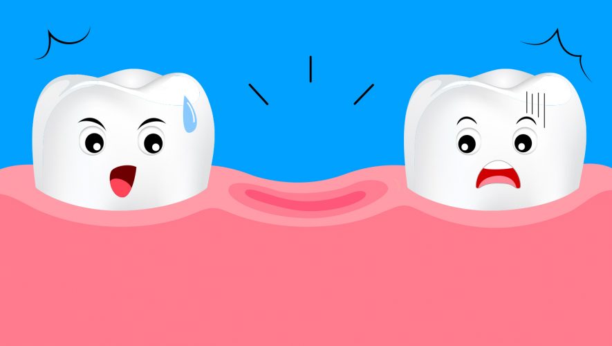sprijecite gubitak zdravog zuba oralna higijena curasept paradontoza gingivitis