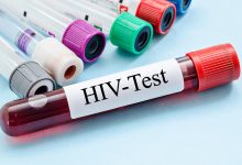 Europski tjedan testiranja na HIV
