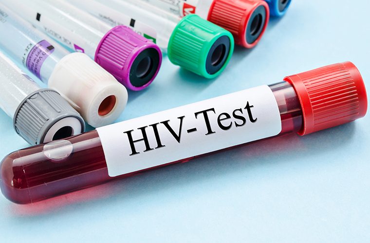 Europski tjedan testiranja na HIV