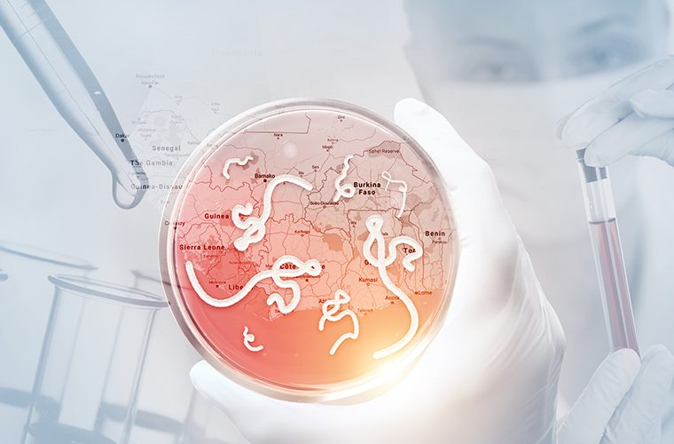 ebola virus simptomi