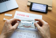 kucni test za COVID-19 koronavirus antigenski PCR testiranje