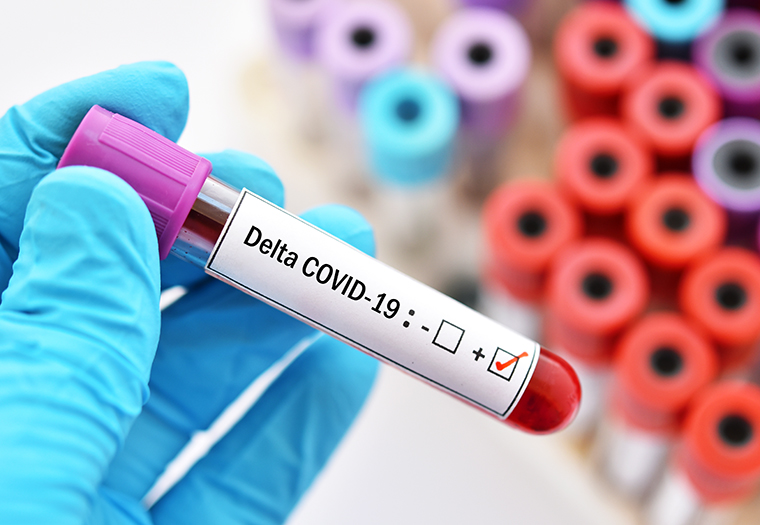 Patogeniji soj: 5 vaznih stvari koje trebate znati o delta varijanti koronavirusa