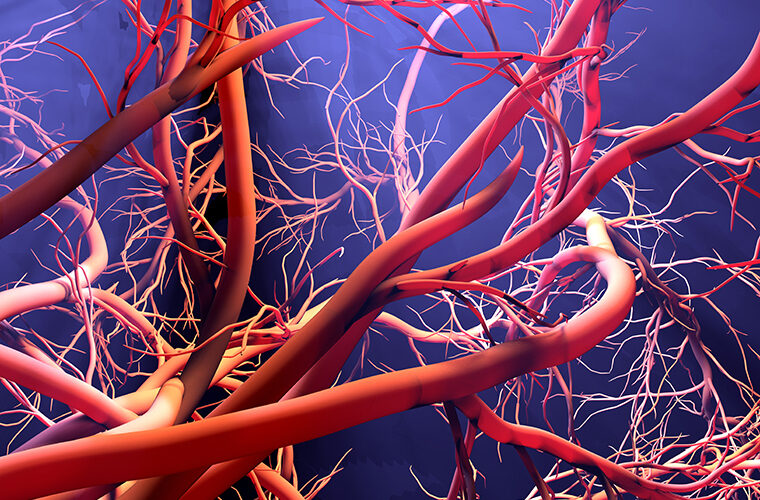 srce krvne žile mikrovaskularna bolest srčani udar