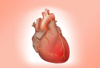 srcane-bolesti-bolesti-srca-perikarditis-bolesti-perikarda-lijecenje-srcanih-bolest