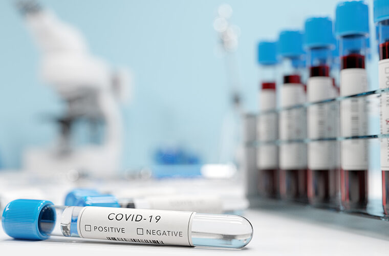 testiranje stanicnog imuniteta nova metoda testiranja COVID-19