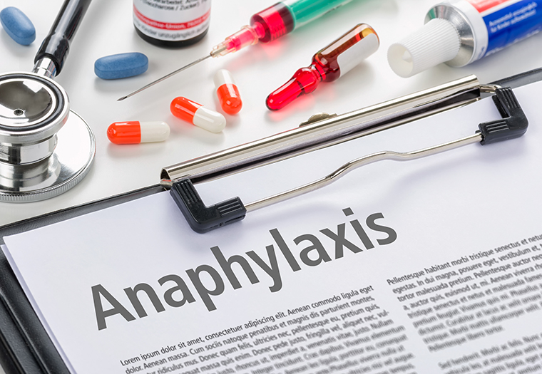 udkast mastermind højde Anafilaksija: kako se liječi po život opasna alergijska reakcija