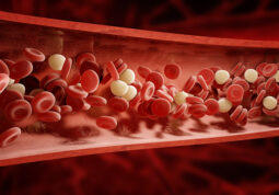 gusta krv hiperkoagulabilnost