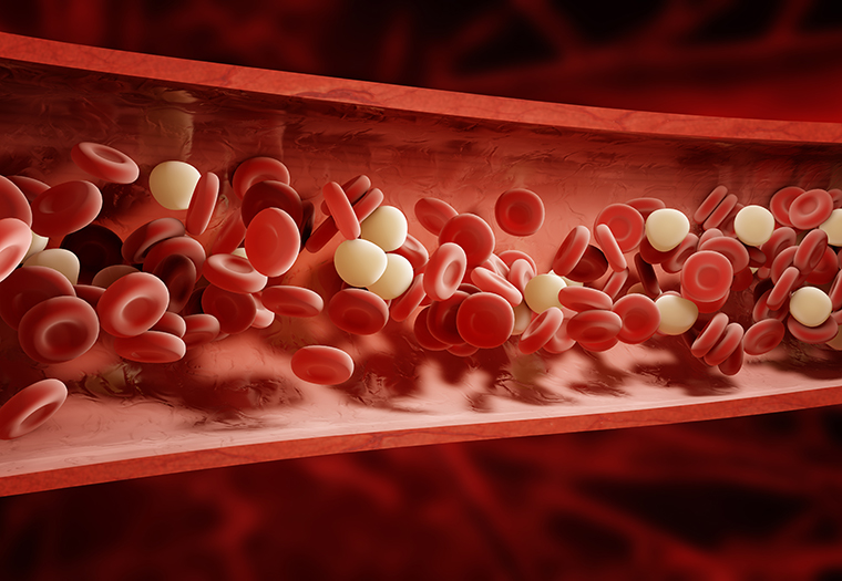 gusta krv hiperkoagulabilnost