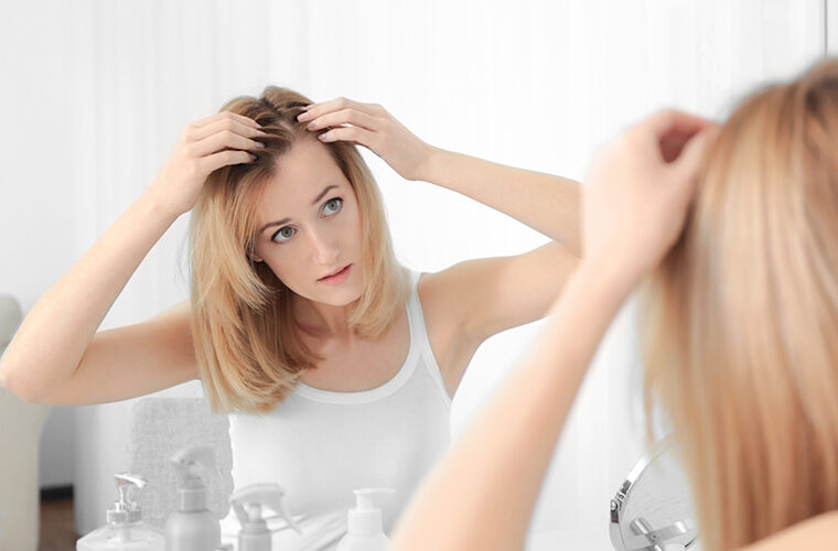 alopecija