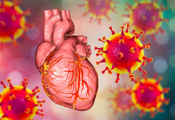 post COVID-19 kardiovaskularne smetnje bolesti srca
