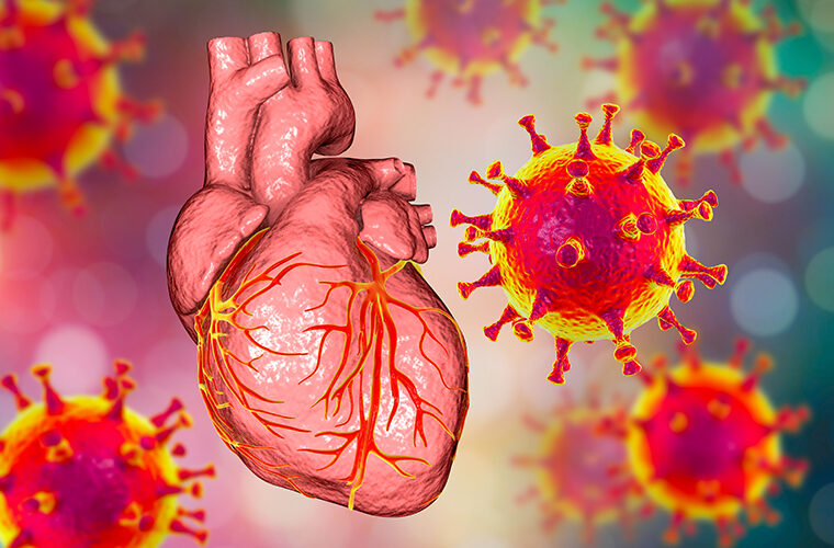 post COVID-19 kardiovaskularne smetnje bolesti srca