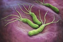 helicobacter pylori bakterija-cir na zelucu