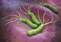 helicobacter pylori bakterija-cir na zelucu