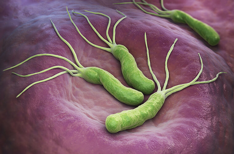 helicobacter pylori bakterija-cir na zelucu