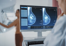 mamografija ili ultrazvuk dojki