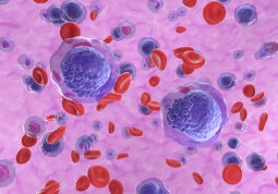 mijeloična leukemija-zloćudna bolest