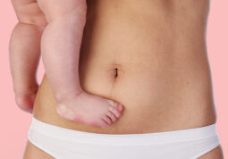 dijastaza-trudnički trbuh