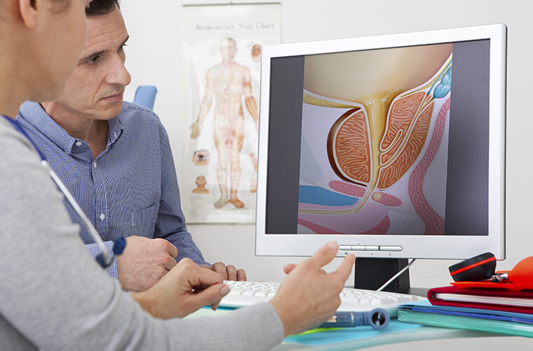 prostektomija-operacija prostate