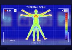 termografija-napredna dijagnostika bolova i ozljeda