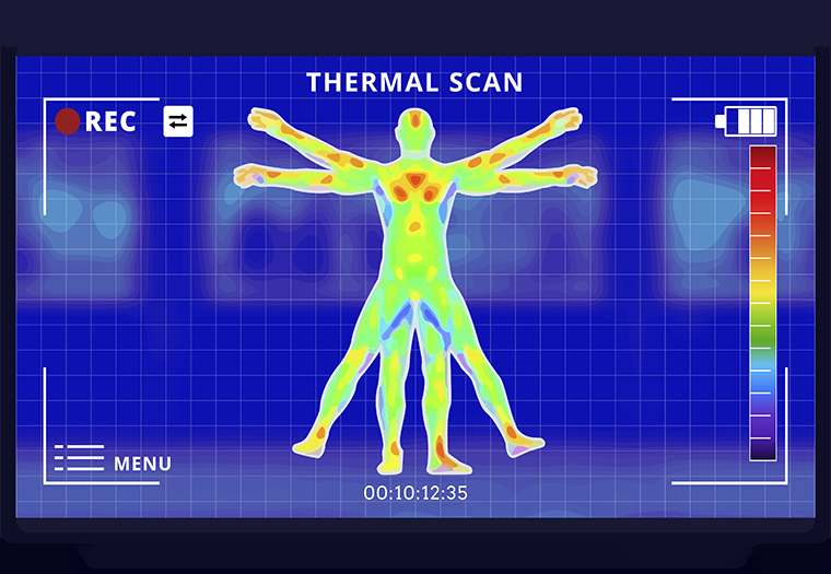 termografija-napredna dijagnostika bolova i ozljeda