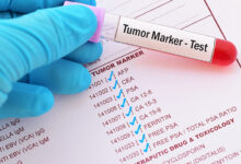 tumorski markeri u ginekologiji