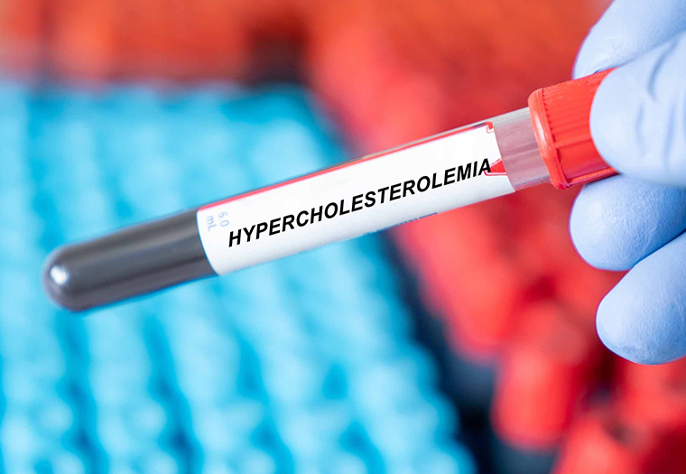 hiperkolesterolemija