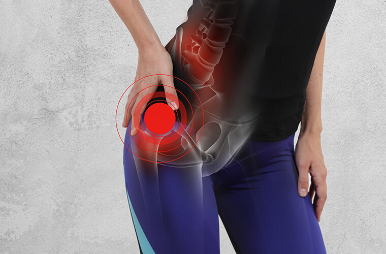 FAI femoroacetabularni impingement-bolovi u kuku