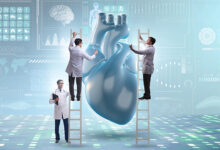 sistematski pregled srca