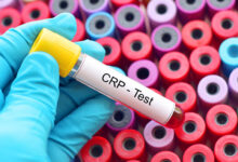 crp test-C reaktivni protein
