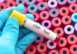 crp test-C reaktivni protein