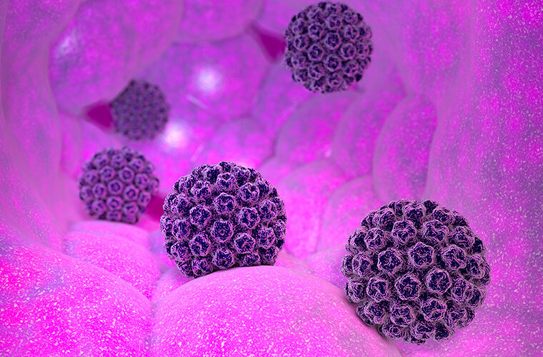 HPV virus-rekurirajuća respiratorna papilomatoza (RRP)