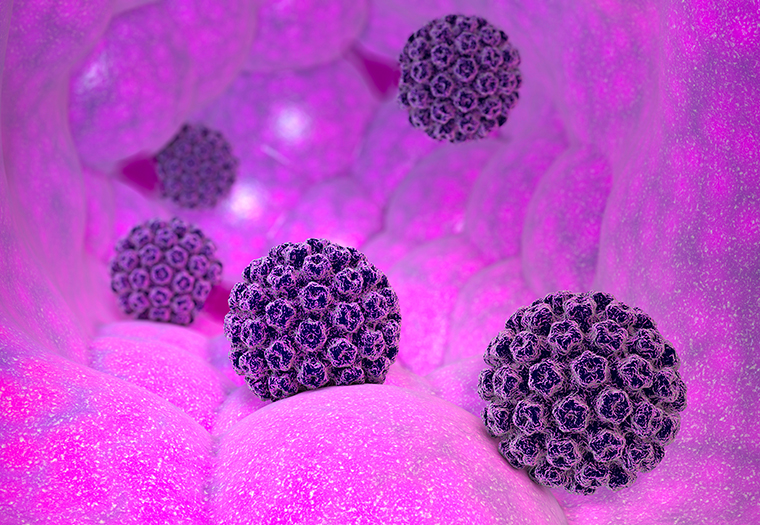 HPV virus-rekurirajuća respiratorna papilomatoza (RRP)